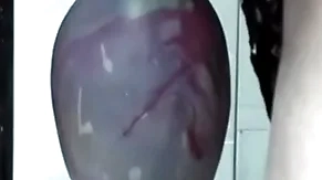 Jumbo tip-in gapes his pain in the neck